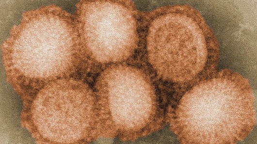 Micrograph of influenza viruses (Image: Cybercobra via Wikipedia)