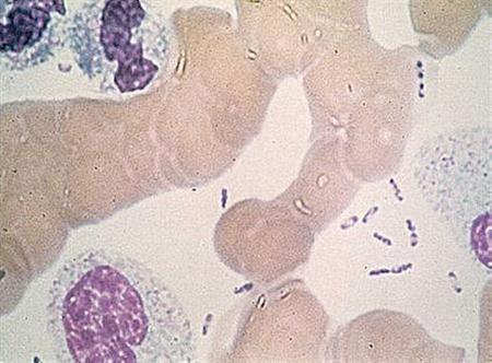 Scientists Crack Black Death's Genetic Code Photo: Reuters/CDC