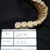Close-up of teeth from a plague victim (Photo: Museum of London)