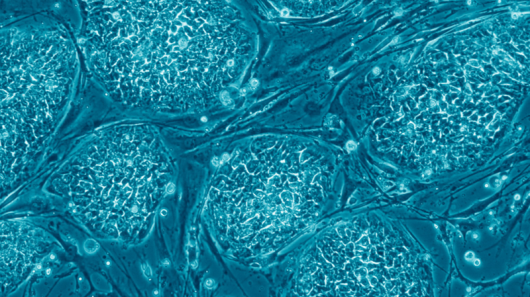 Scientists have reversed the aging process in human adult stem cells, which are in turn re...